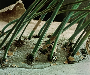 Eyelash hairs, SEM