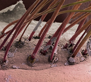 Eyelash hairs, SEM