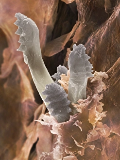 Eyelash mite, SEM