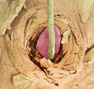 Eyelash mite tail, SEM