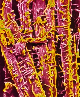 F/col SEM of cholesterol crystals F/col SEM of cholesterol crystals