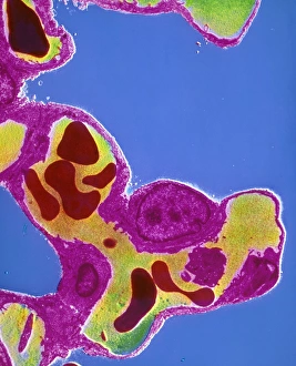 F/col TEM of capillary in alveolar septum of lung F/col TEM of capillary in alveolar septum of lung