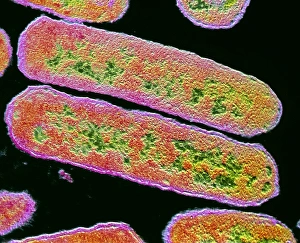 F/col TEM of Haemophilus influenzae F/col TEM of Haemophilus influenzae