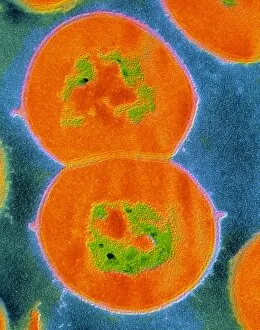 F/col TEM of Streptococcus viridans