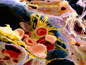 F. colour SEM of macrophage & blood cells in liver F. colour SEM of macrophage & blood cells in liver