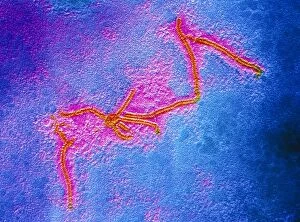 Images Dated 2nd April 1986: False-col TEM of measles virus