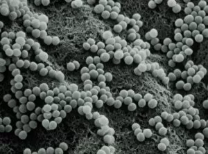False-col TEM of Staphylococcus aureus