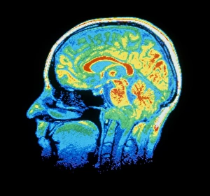 False-colour NMR scan of the head, sagittal slice False-colour NMR scan of the head, sagittal slice