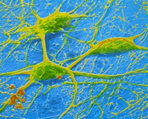 Images Dated 8th June 1989: False-colour SEM of 3 neurones of cerebral cortex