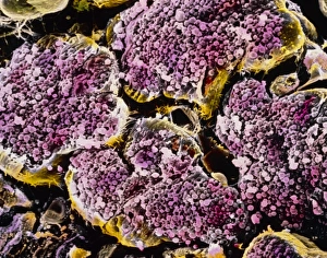 False-colour SEM of acini cells of the pancreas False-colour SEM of acini cells of the pancreas