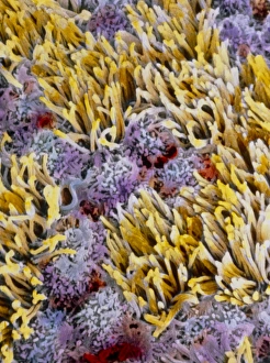 False-colour SEM of epithelium of Fallopian tube False-colour SEM of epithelium of Fallopian tube