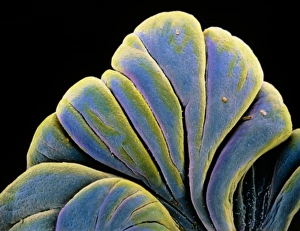 False-colour SEM of fimbriae in an embryo False-colour SEM of fimbriae in an embryo