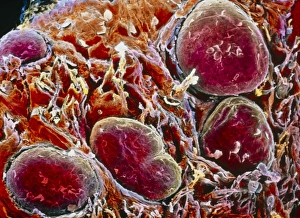 False-colour SEM of fungiform papillae on tongue False-colour SEM of fungiform papillae on tongue