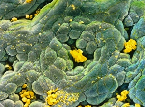 False-colour SEM of gastric gland in stomach False-colour SEM of gastric gland in stomach