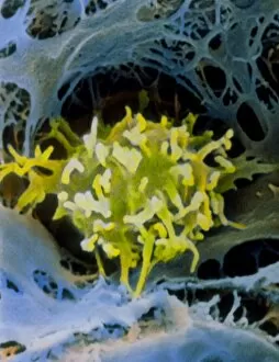Images Dated 21st May 1992: False-colour SEM of macrophage in liver