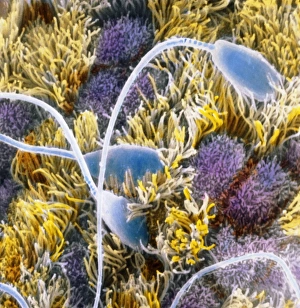 False-colour SEM of sperm on uterine surface False-colour SEM of sperm on uterine surface