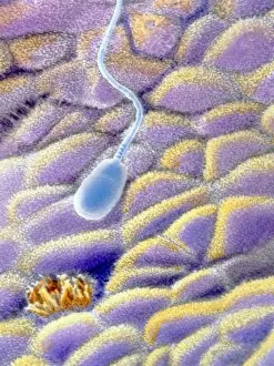 False-colour SEM of a spermatozoon on uterus wall