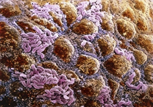 False-colour SEM of wall of colon, with bacteria False-colour SEM of wall of colon, with bacteria