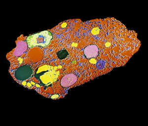 False-colour TEM of Entamoeba histolytica False-colour TEM of Entamoeba histolytica