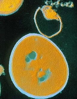 Images Dated 11th February 2003: False-colour TEM of Staphylococcus aureus
