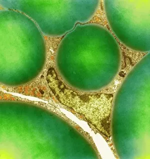Specialist Imaging Gallery: Fat cells, TEM