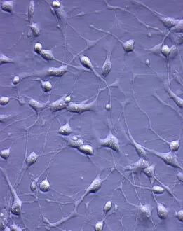 Cell Body Gallery: Foetal neurons