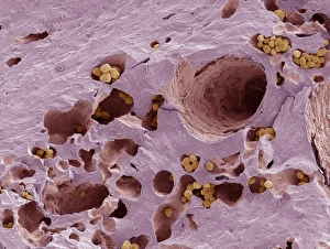 Fossilised compact bone, SEM Fossilised compact bone, SEM