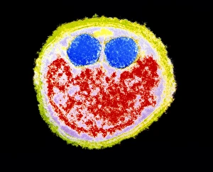 Images Dated 2nd August 1993: Fusobacterium nucleatum bacterium