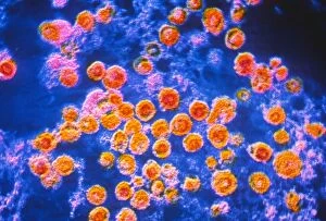 Images Dated 2nd April 1986: German measles viruses