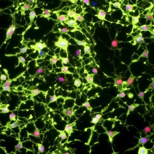Confocal Gallery: Glial stem cell culture, light micrograph