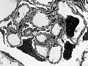 Images Dated 2013 February: TEM Print of Glomerulus in Human Kidney