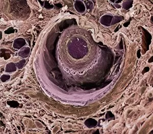 Images Dated 15th February 2002: Hair follicle, SEM