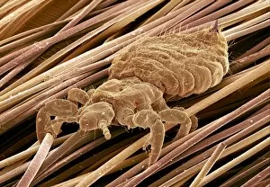 Images Dated 24th July 2000: Head louse