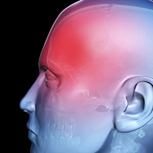 Headache, conceptual artwork
