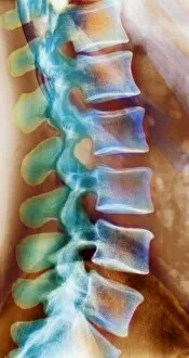 Images Dated 4th February 2004: Healthy lower spine, X-ray