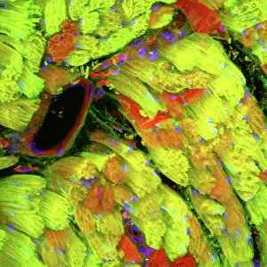Heart muscle, confocal light micrograph