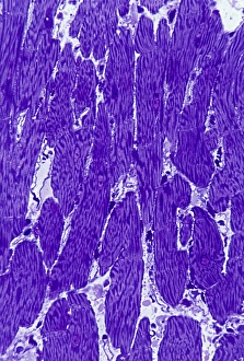 Nuclei Gallery: Heart muscle, light micrograph C016 / 0517