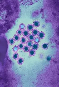 Images Dated 7th January 2002: Hepatitis B viruses