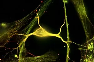 Hippocampal neuron fluorescent micrograph