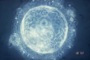 Light Micrograph Gallery: Human blastocyst