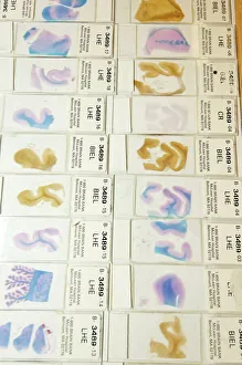 Central Nervous System Gallery: Human brain microscope slides