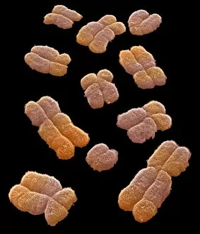 Images Dated 10th July 2001: Human chromosomes, SEM
