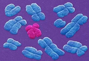 Images Dated 10th July 2001: Human chromosomes, SEM