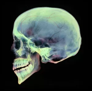 Tooth Gallery: Human skull, X-ray
