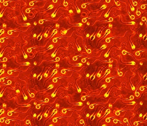 Human sperm cells Human sperm cells