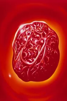 Images Dated 25th October 1995: Illustration of blood cells & fibrin in a thrombus