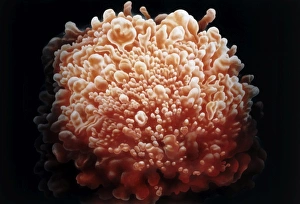 Illustration of HTLV-1 infected T4-lymphocyte cell Illustration of HTLV-1 infected T4-lymphocyte cell