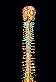 Spinal Gallery: Illustration of the human spinal cord and brain