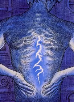 Illustration of back pain