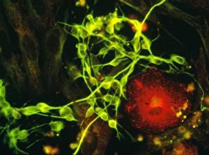 Immunofluorescent LM of macrophage in brain tissue Immunofluorescent LM of macrophage in brain tissue